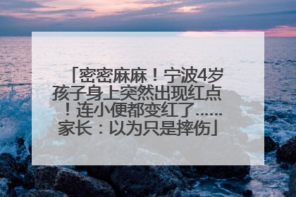 密密麻麻！宁波4岁孩子身上突然出现红点！连小便都变红了……家长：以为只是摔伤